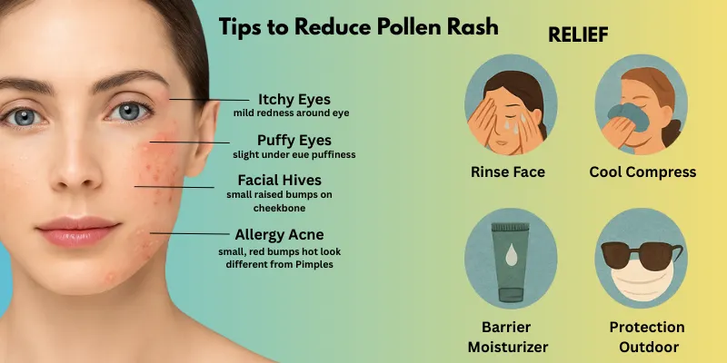 Tips to reduce pollen Rash